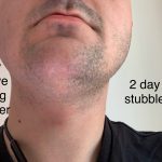 Dry shave using the electric shaver compared to untouched two day stubble